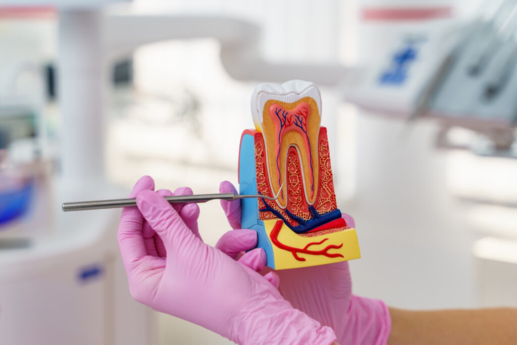 Root Canal Re-treatment